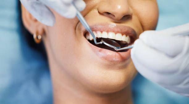 Best Dental Abscess Treatment in Black Rock, NM
