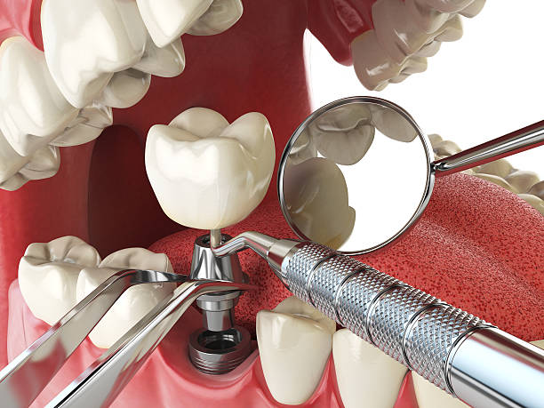 Reliable NM Emergency Dental Service Solutions